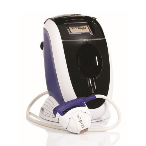 Intense Pulse Light Treatment (IPL)